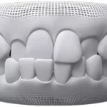 cross bite teeth at bespoke dental Fulham with invisalign