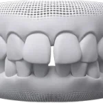 Fix Gaps in teeth at bespoke dental Fulham with invisalign