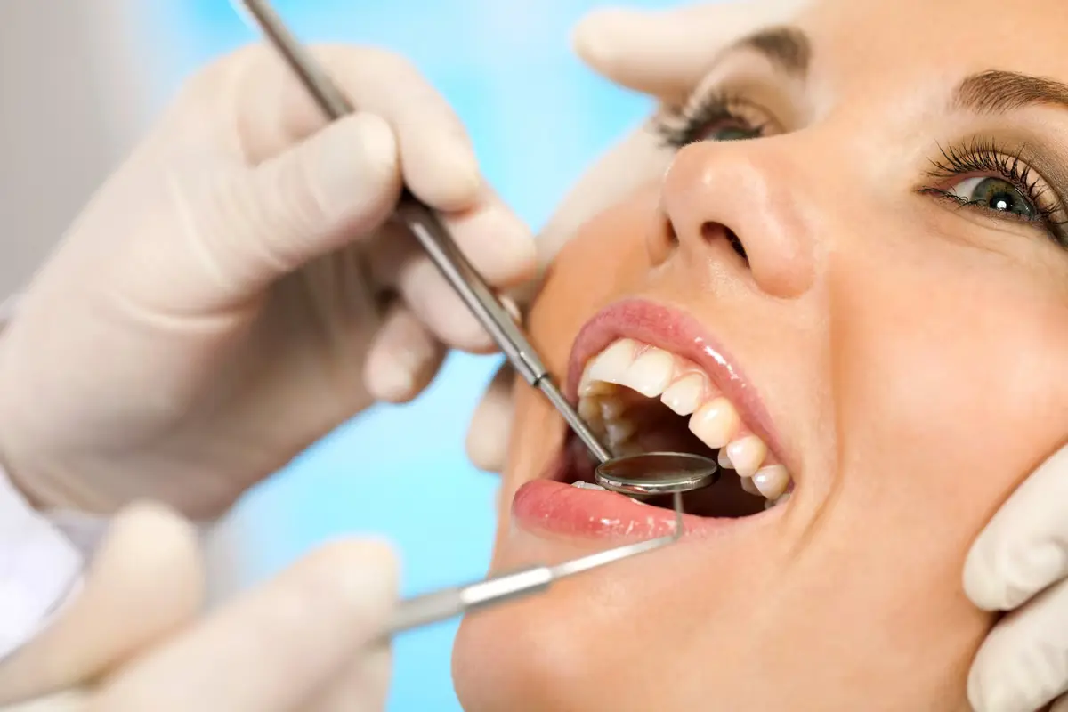 Porcelain Veneers at Bespoke Dental Fulham