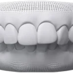 Fix overbite teeth at bespoke dental Fulham with invisalign