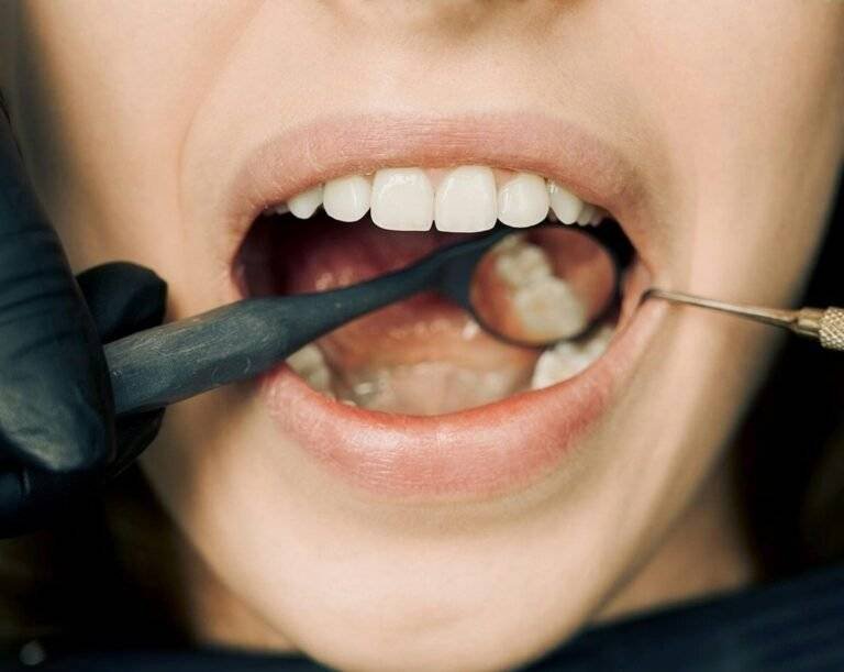 hygiene treatment bespoke dental fulham