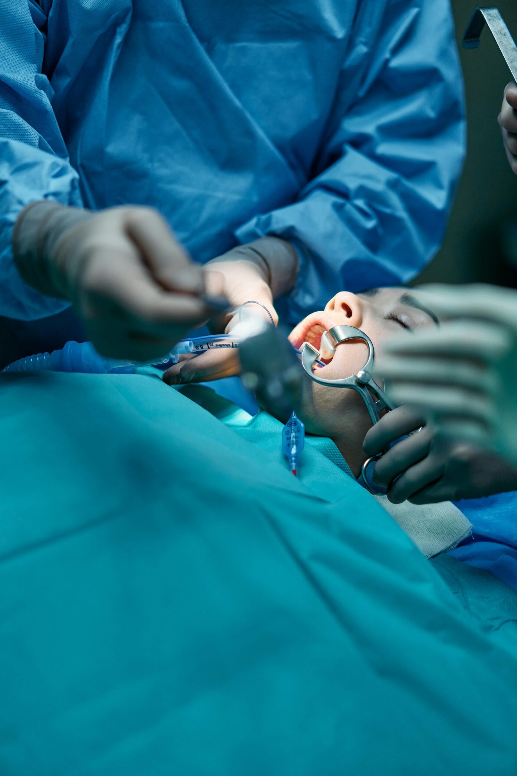 What is a Root Canal Bespoke Dental Fulham