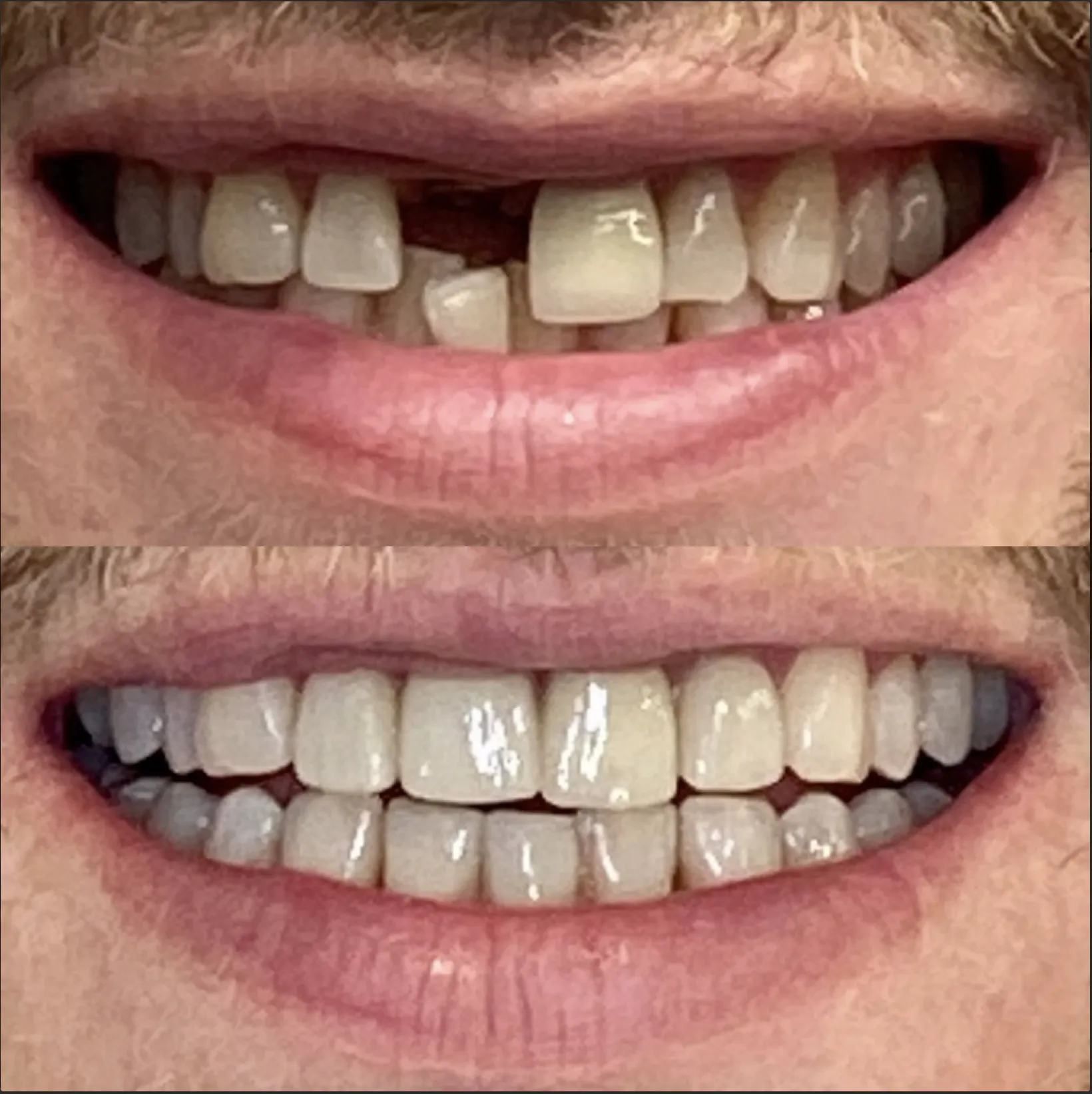 7fcde698ac915096ed765fcc634f1df923293730